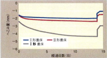 局部圧縮クリープ試験